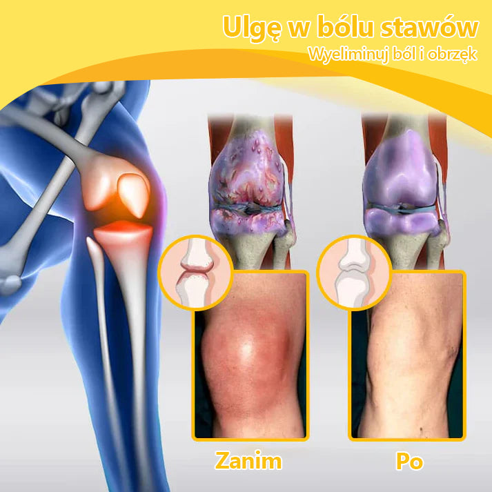 🍀🍀ArthroFree™ Krem na ból kości z jadem pszczelim🐝(Szczególnie dla osób starszych i zalecane przez AAOS) x