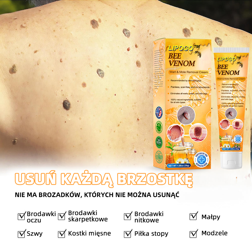 🎉🎉 LIPOGO™ Krem do usuwania brodawek i znaczników z jadem pszczelim(👨‍⚕Suitable dla wszystkich rodzajów skóry)🐝(🔥Ostatni dzień promocji 70% taniej)