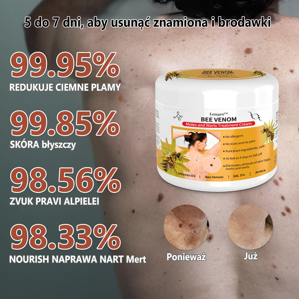 [🍀Oficjalny sklep marki🍀] 🐝🐝Lenaro™ Krem na znamiona i brodawki z jadem pszczelim(👨‍⚕AAD ZALECA)1