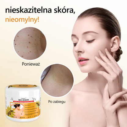 [🍀Oficjalny sklep marki🍀] 🐝🐝Lenaro™ Krem na znamiona i brodawki z jadem pszczelim(👨‍⚕AAD ZALECA)1