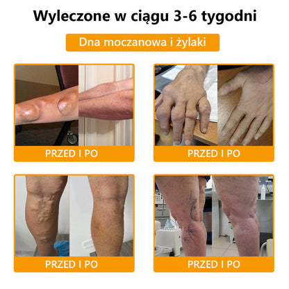 🍀🍀ArthroFree™ Krem na ból kości z jadem pszczelim🐝(Szczególnie dla osób starszych i zalecane przez AAOS) x