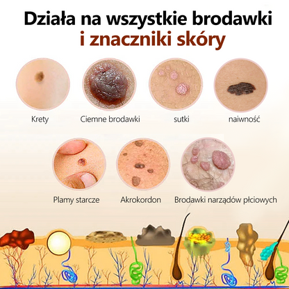 [🍀Oficjalny sklep marki🍀] 🐝🐝Lenaro™ Krem na znamiona i brodawki z jadem pszczelim(👨‍⚕AAD ZALECA)1