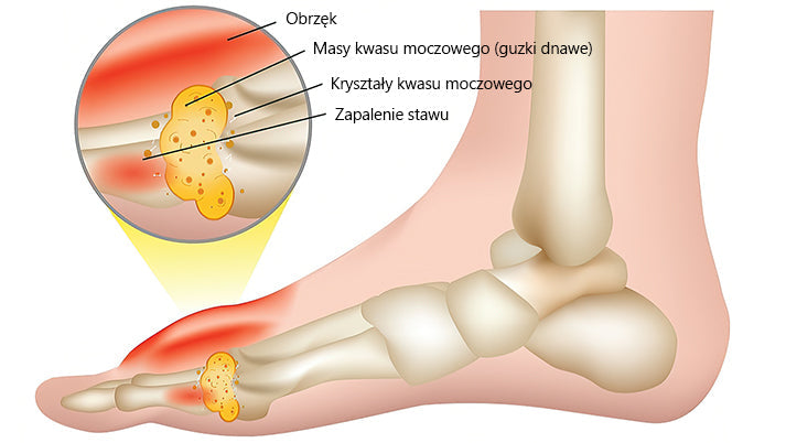 🍀🍀ArthroFree™ Krem na ból kości z jadem pszczelim🐝(Szczególnie dla osób starszych i zalecane przez AAOS) x