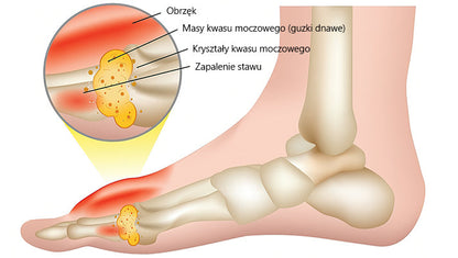 🍀🍀ArthroFree™ Krem na ból kości z jadem pszczelim🐝(Szczególnie dla osób starszych i zalecane przez AAOS) x