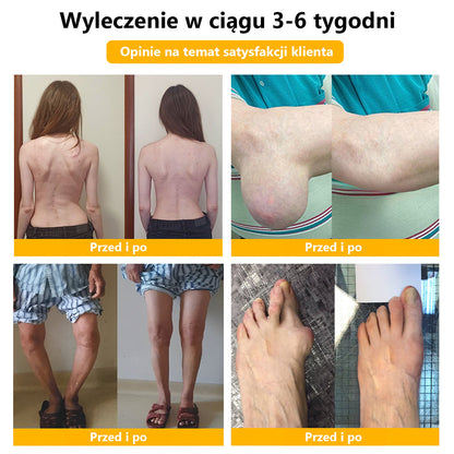 🍀🍀ArthroFree™ Krem na ból kości z jadem pszczelim🐝(Szczególnie dla osób starszych i zalecane przez AAOS) x