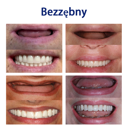 Bikenda™ Silikonowy Zestaw Do Mierzenia Protez 🧨🧨 (👩‍🔬 Zgodny z CED, zatwierdzony przez profesjonalnych dentystów)