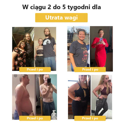 🎉🎉 𝐂𝐯𝐫𝐞𝐨𝐳™ Plaster Na Odchudzanie Z Jadem Pszczelim⭐(Na Wszystkie Problemy Limfatyczne I Otyłość)