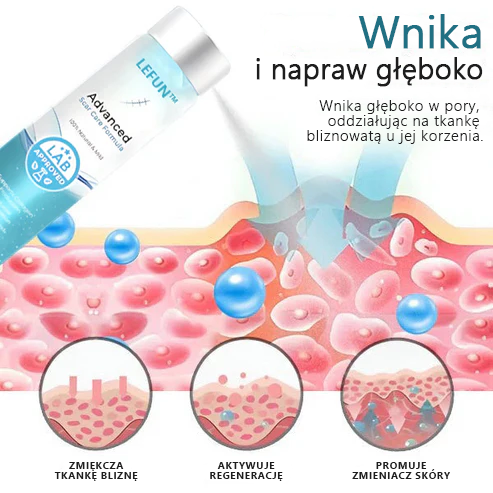 🌿Zaawansowany 💧LEFUN™ spray na blizny dla wszystkich typów blizn - na przykład blizny po trądziku, blizny pooperacyjne i rozstępy