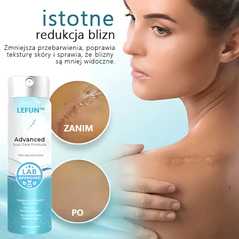 🌿Zaawansowany 💧LEFUN™ spray na blizny dla wszystkich typów blizn - na przykład blizny po trądziku, blizny pooperacyjne i rozstępy