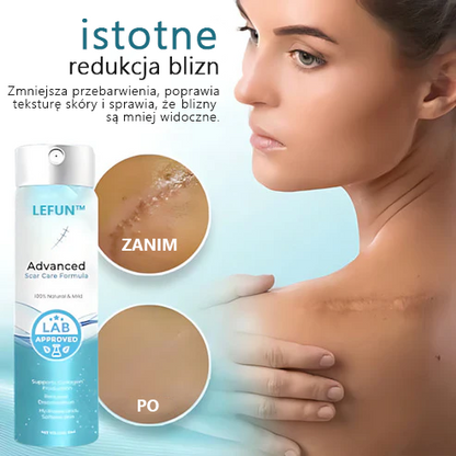 🌿Zaawansowany 💧LEFUN™ spray na blizny dla wszystkich typów blizn - na przykład blizny po trądziku, blizny pooperacyjne i rozstępy