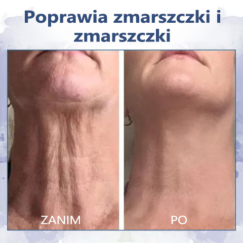 🫧Ostatni Dzień Zniżki 80% Taniej🫧Fubsta® Zaawansowany Ujędrniający Krem Przeciwzmarszczkowy: Przywraca Elastyczność Skóry🫧