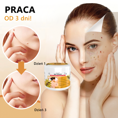 [🍀Oficjalny sklep marki🍀] 🐝🐝Lenaro™ Krem na znamiona i brodawki z jadem pszczelim(👨‍⚕AAD ZALECA)1